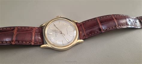 how to remove the back of a patek philippe watch|Patek Philippe authorized repair.